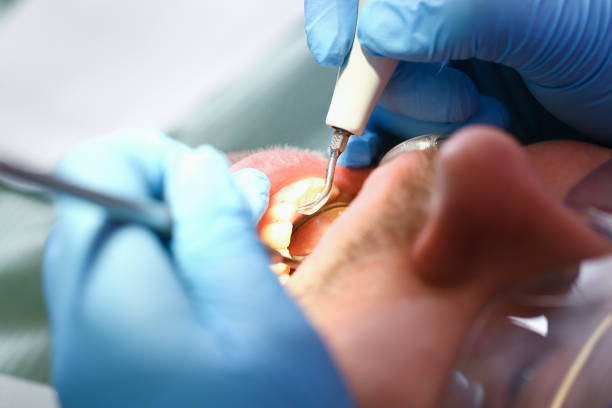 Best Tooth Infection Emergency Dentist  in Princeton, TX