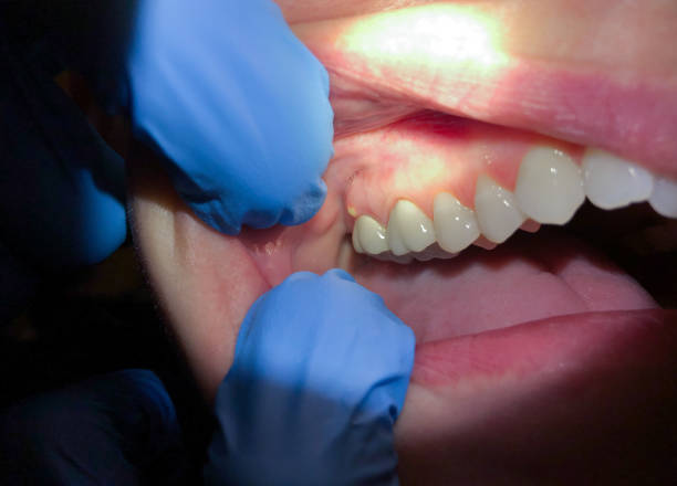 Best Cracked Tooth Emergency Dentist  in Princeton, TX